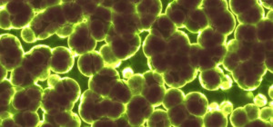 Bacteria 1959386 960 720 2 48276